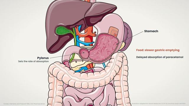 Absorption