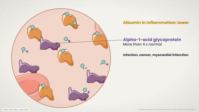 Albumin and alpha-1-acid glycoprotein