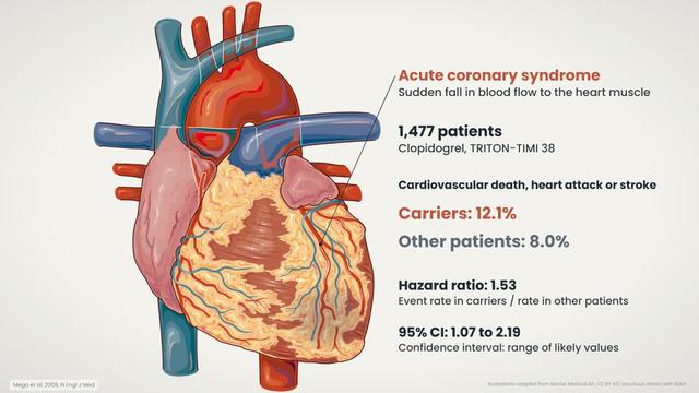 CYP2C19 and the clopidogrel response