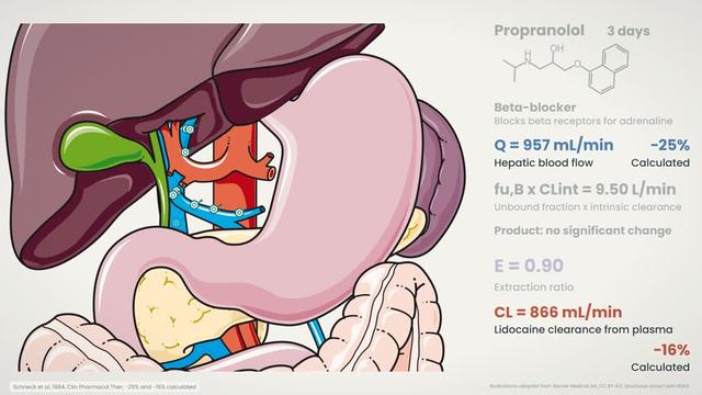Lidocaine